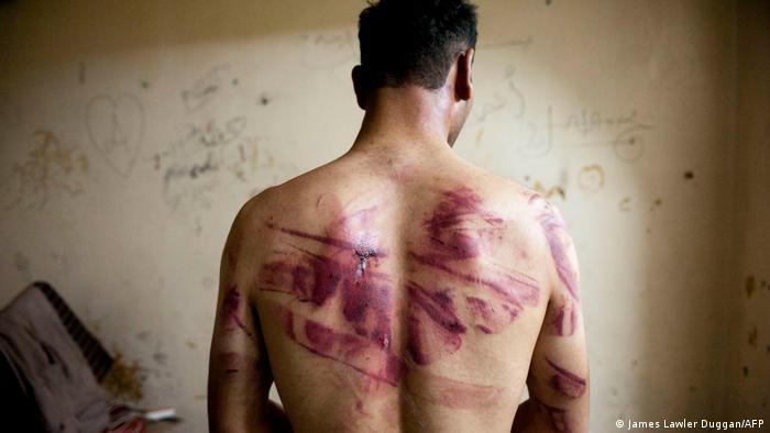 تعذيب السوريين في سجون النظام